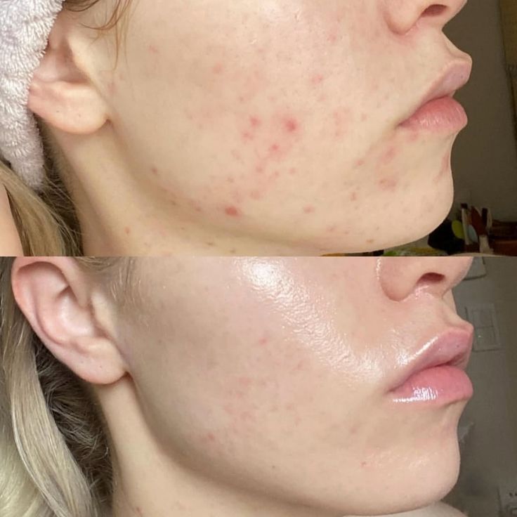 De Ce Pielea Ta Arată Obosită (Și Nu E De La Somn)