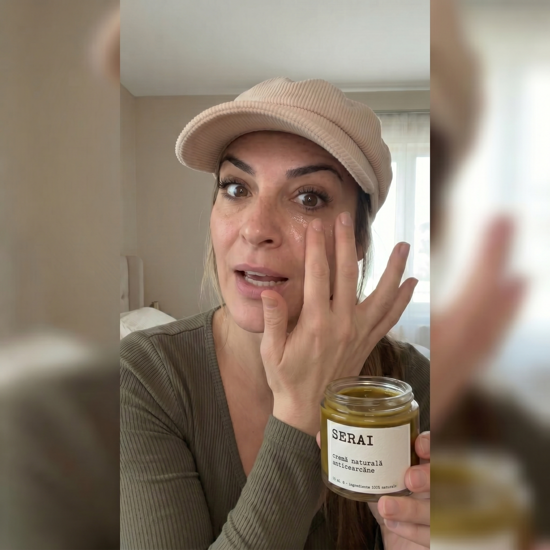 Cearcăne și Pungi Sub Ochi: Cauze Reale și Ce Poți Face Natural