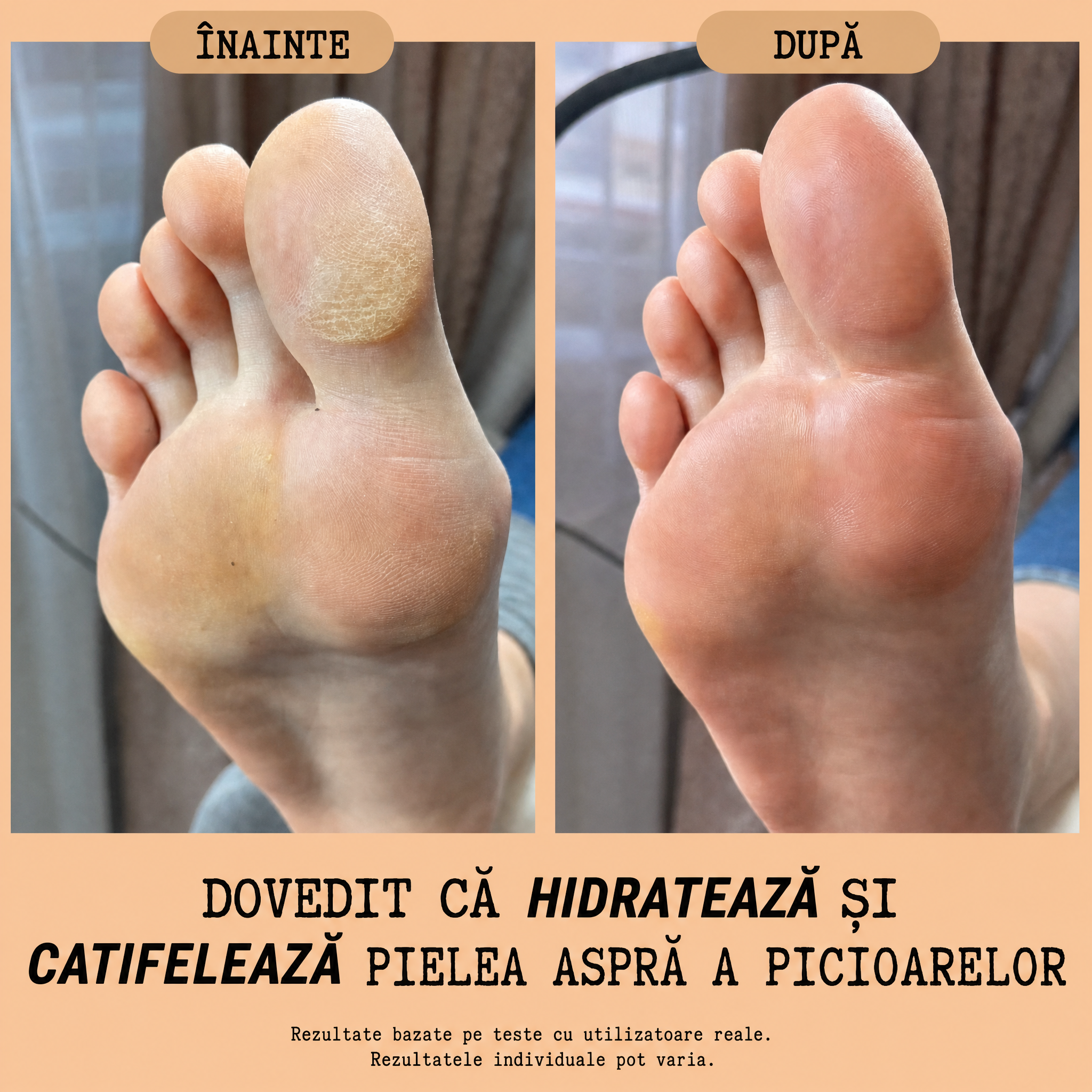 Cremă Naturală Picioare & Călcâie