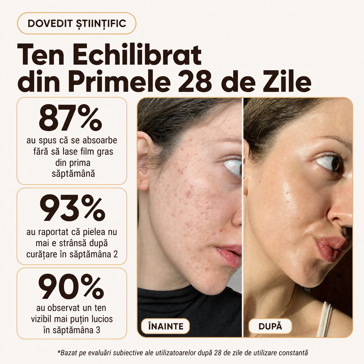 Crema Naturala Ten Gras & Acneic