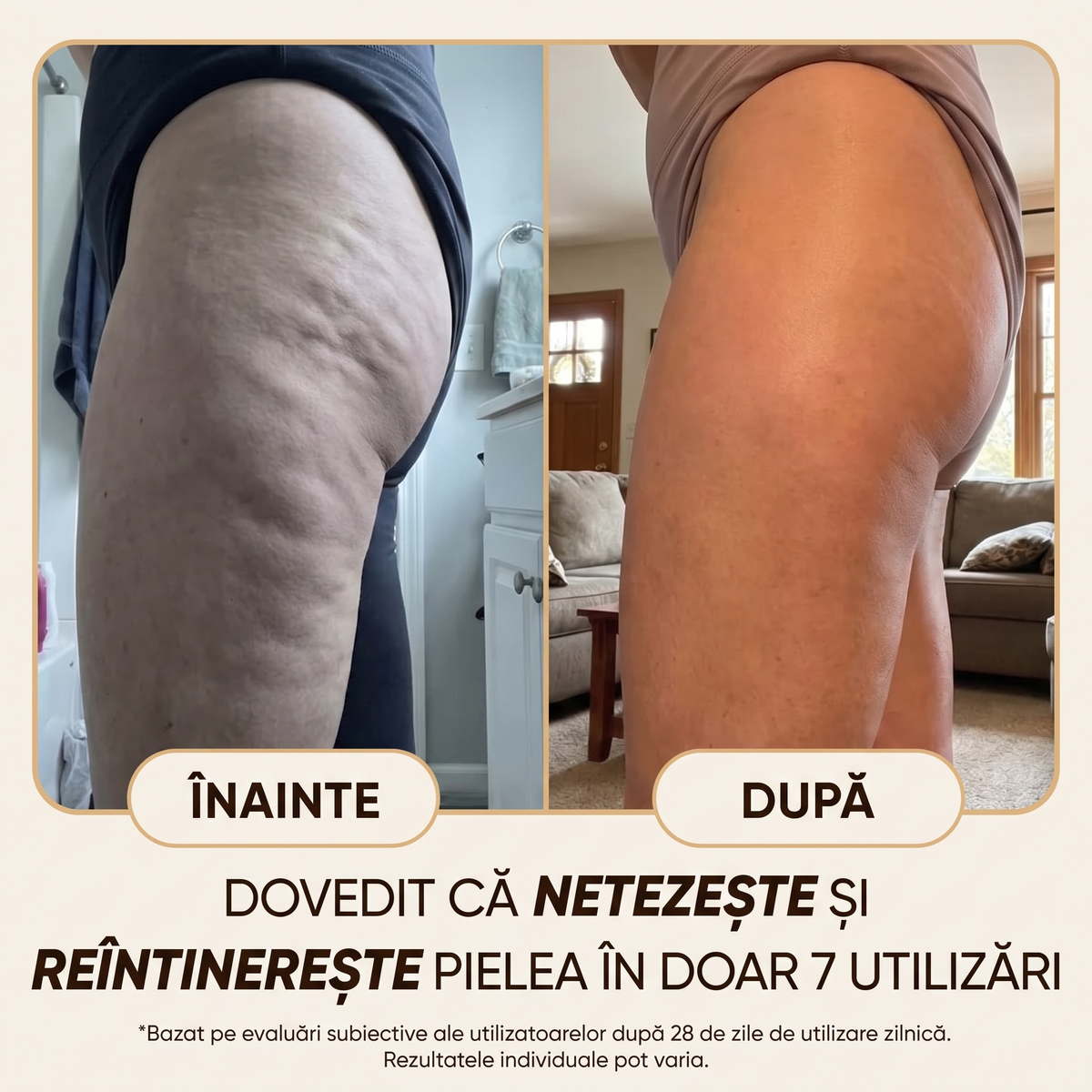 Balsam Natural Anticelulită & Antivergeturi