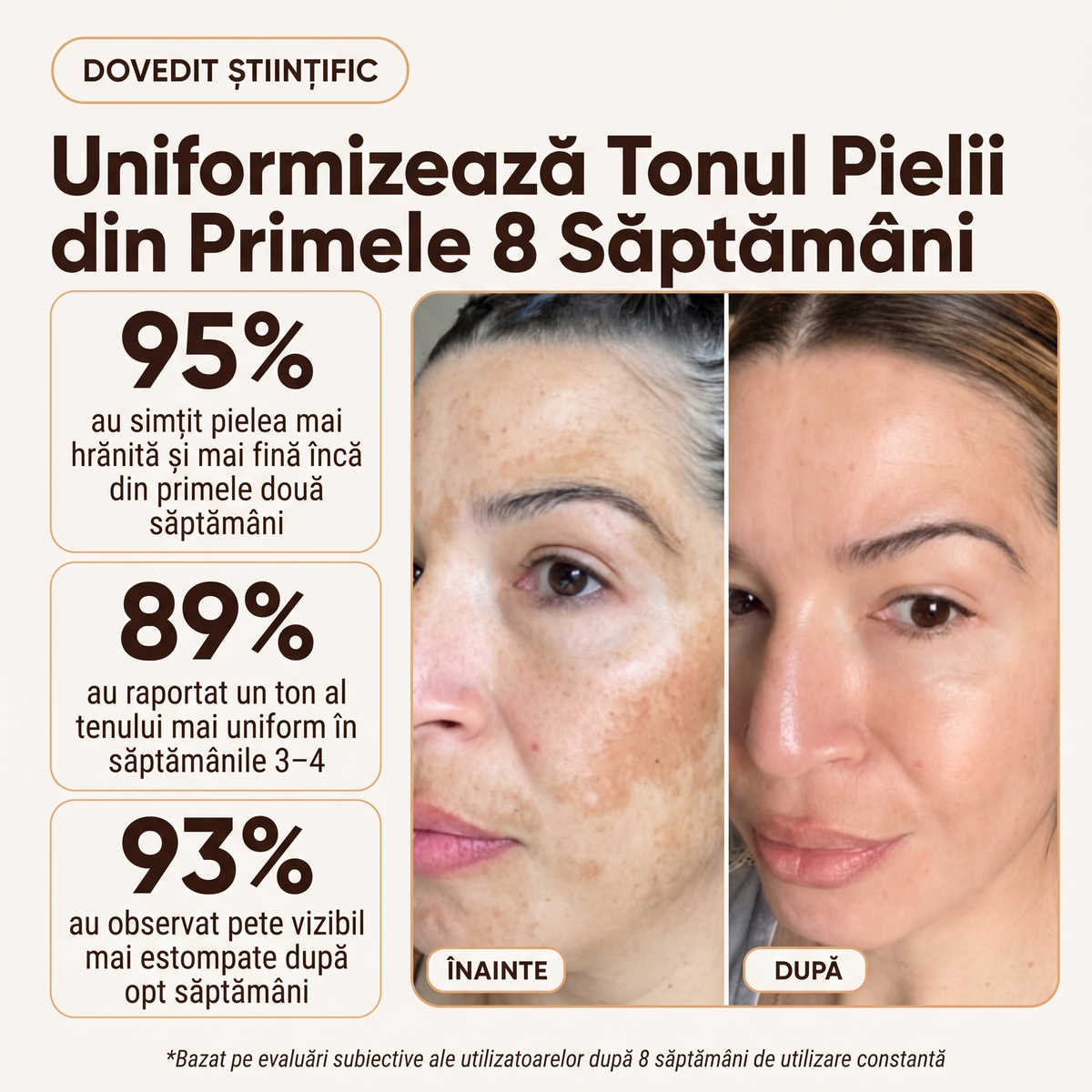 Crema Naturală Antipete