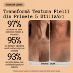 Balsam Natural Corporal Anticelulită & Antivergeturi