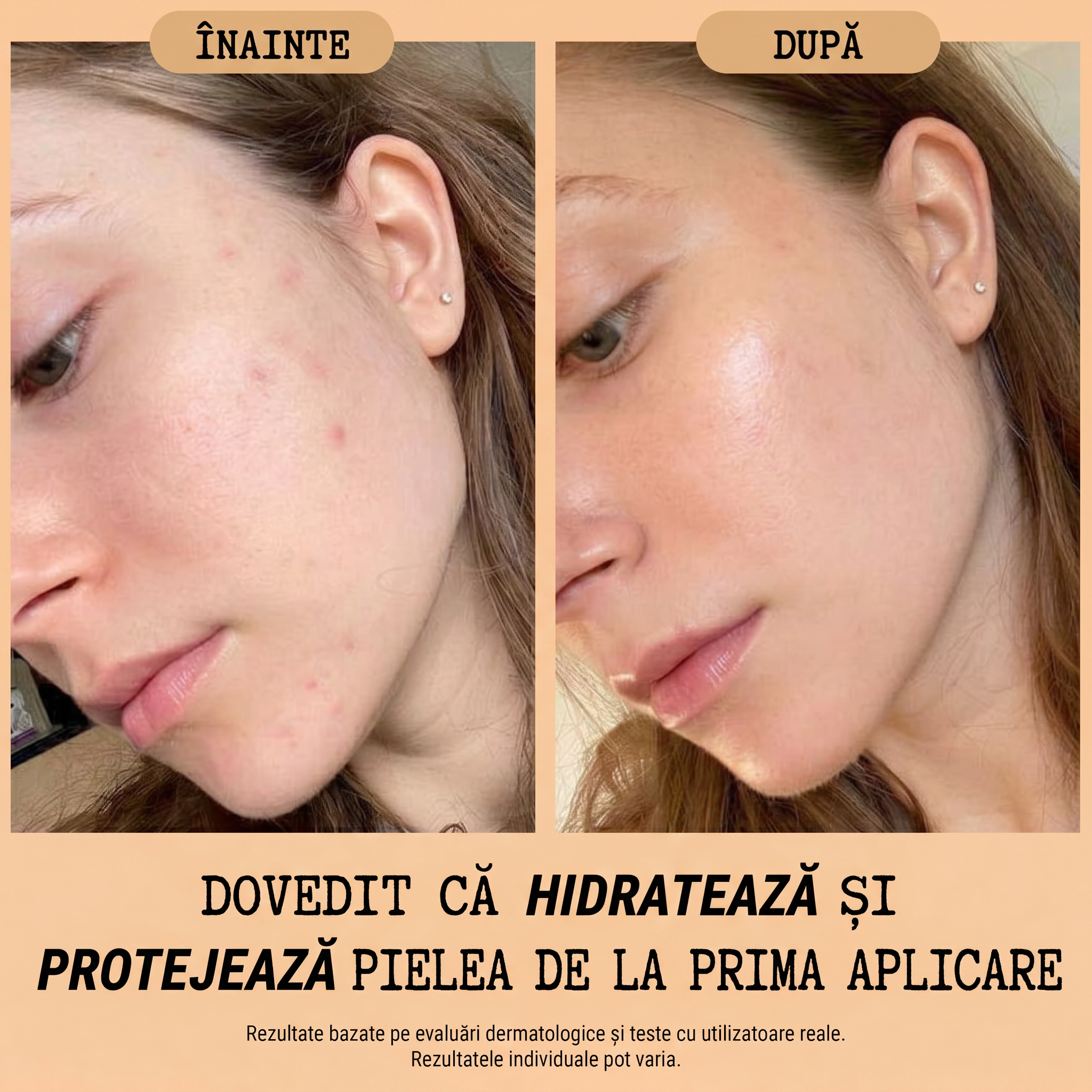 Cremă Naturală de Zi cu Protecție Solară