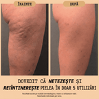 Balsam Natural Corporal Anticelulită & Antivergeturi