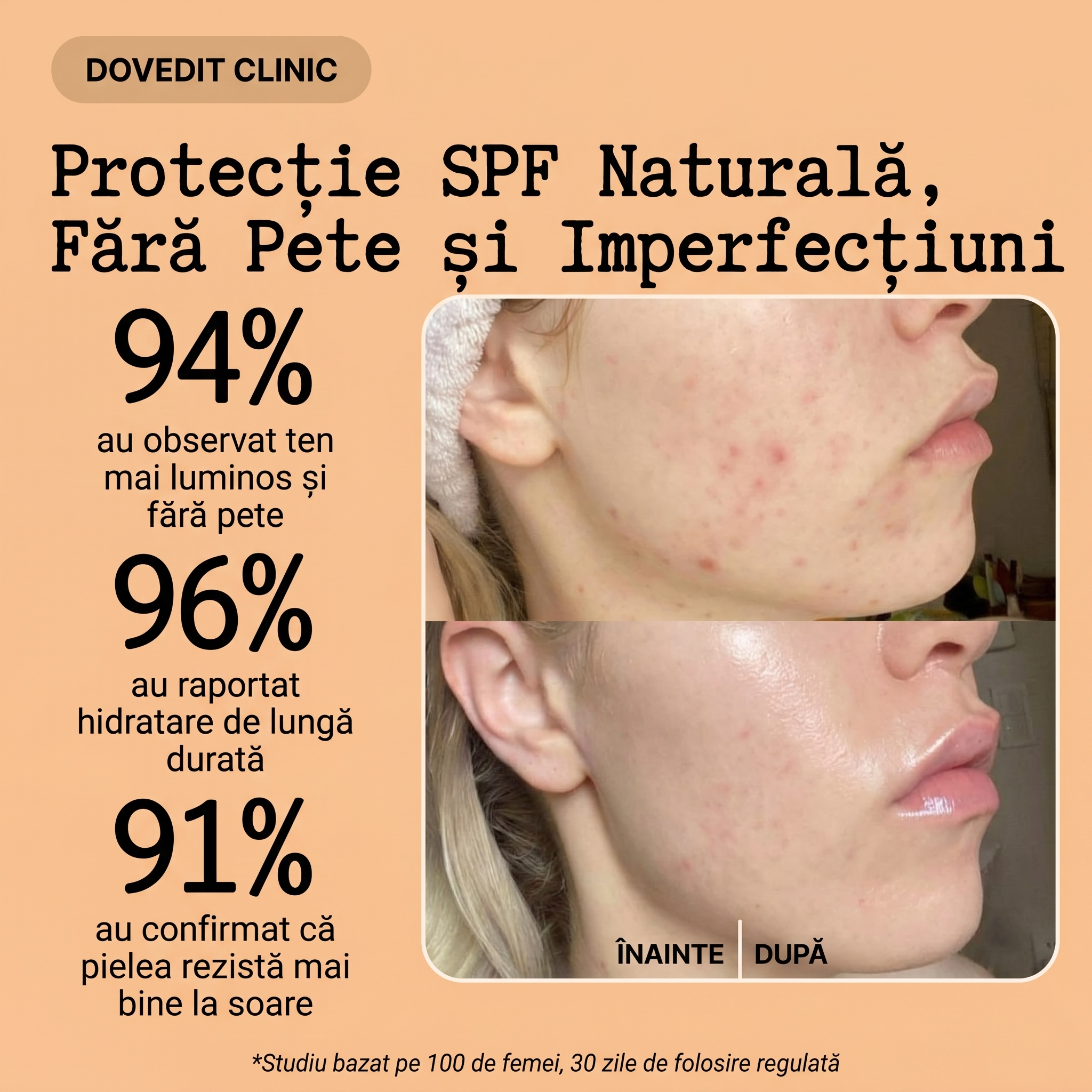 Cremă Naturală de Zi cu Protecție UV