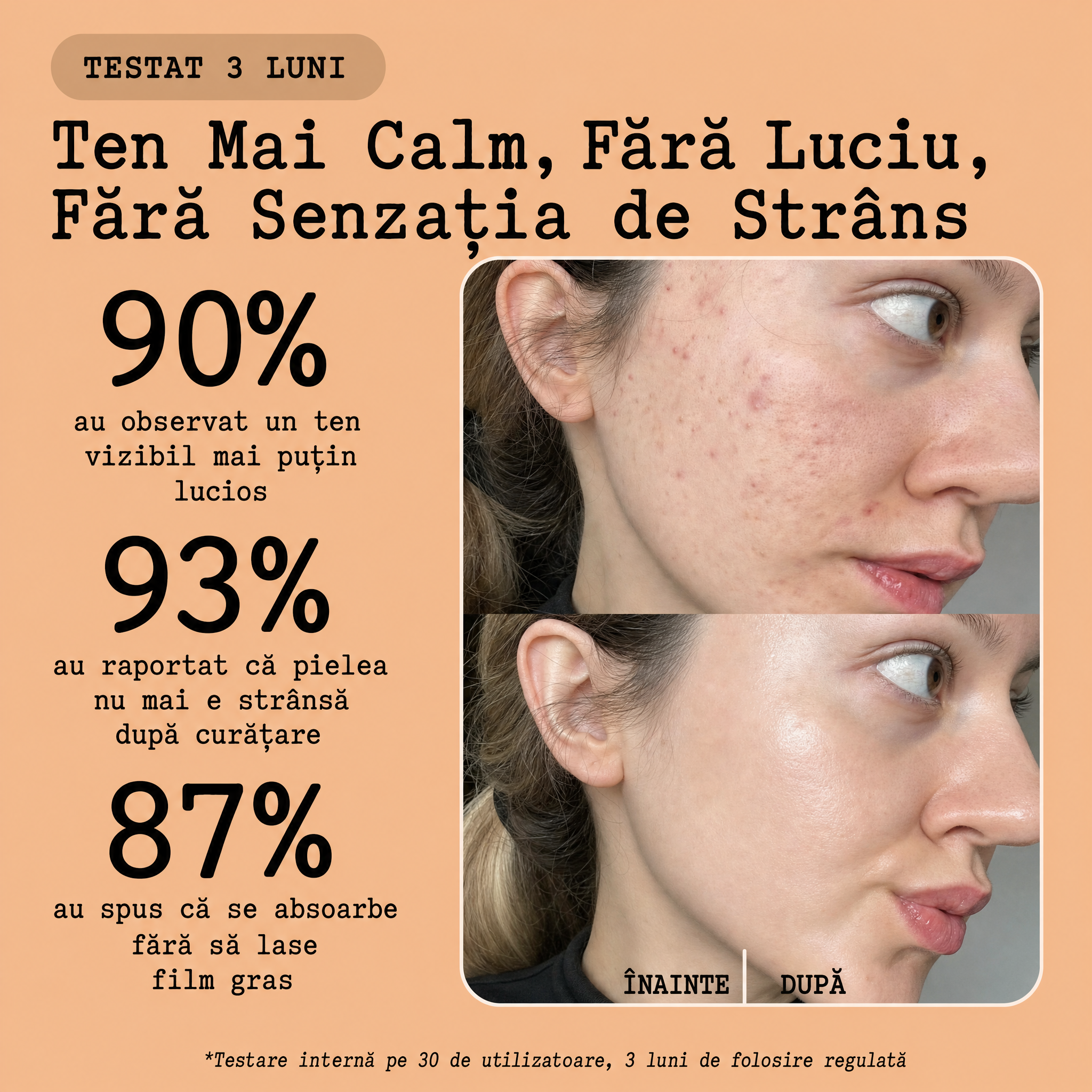 Crema Naturala Ten Gras & Acneic