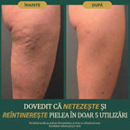 Balsam Natural Corporal Anticelulită & Antivergeturi