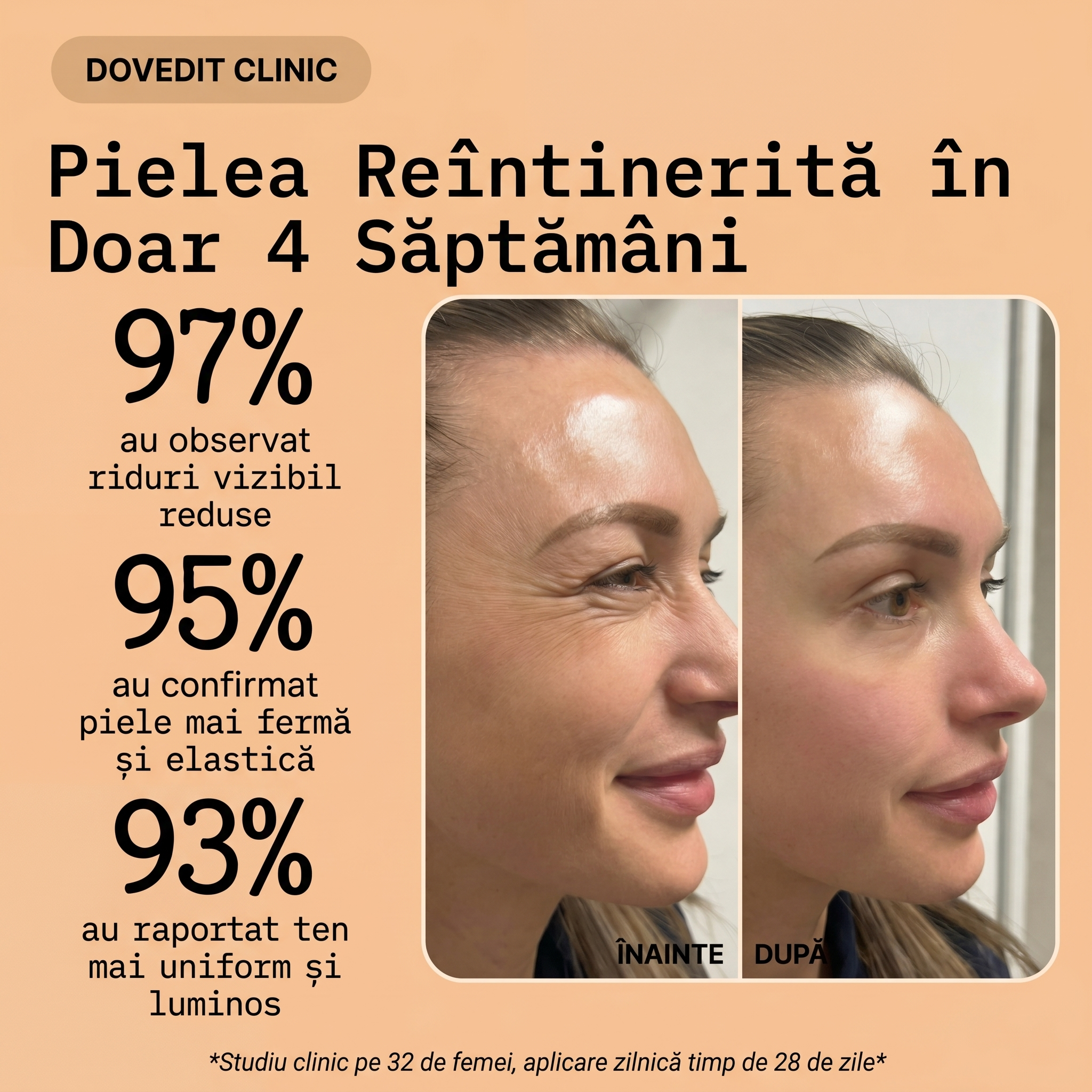 Cremă Naturală Antirid