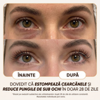 Cremă Naturală Anticearcăne