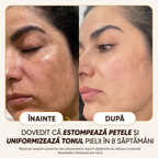 Crema Naturală Antipete