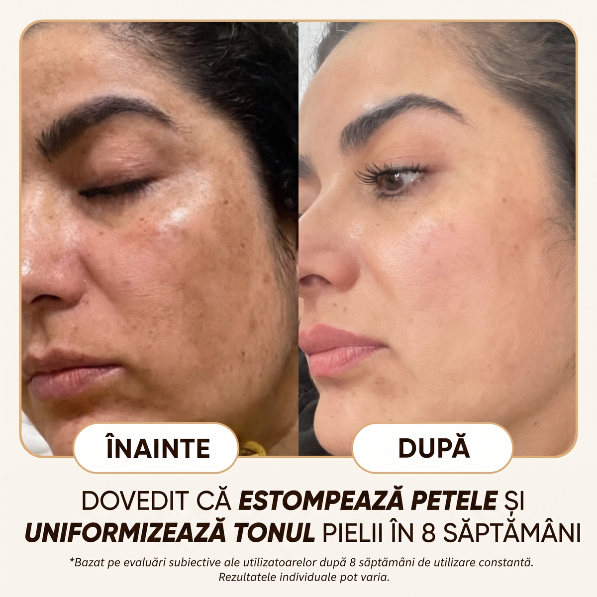 Crema Naturală Antipete