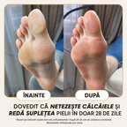 Cremă Naturală Picioare & Călcâie