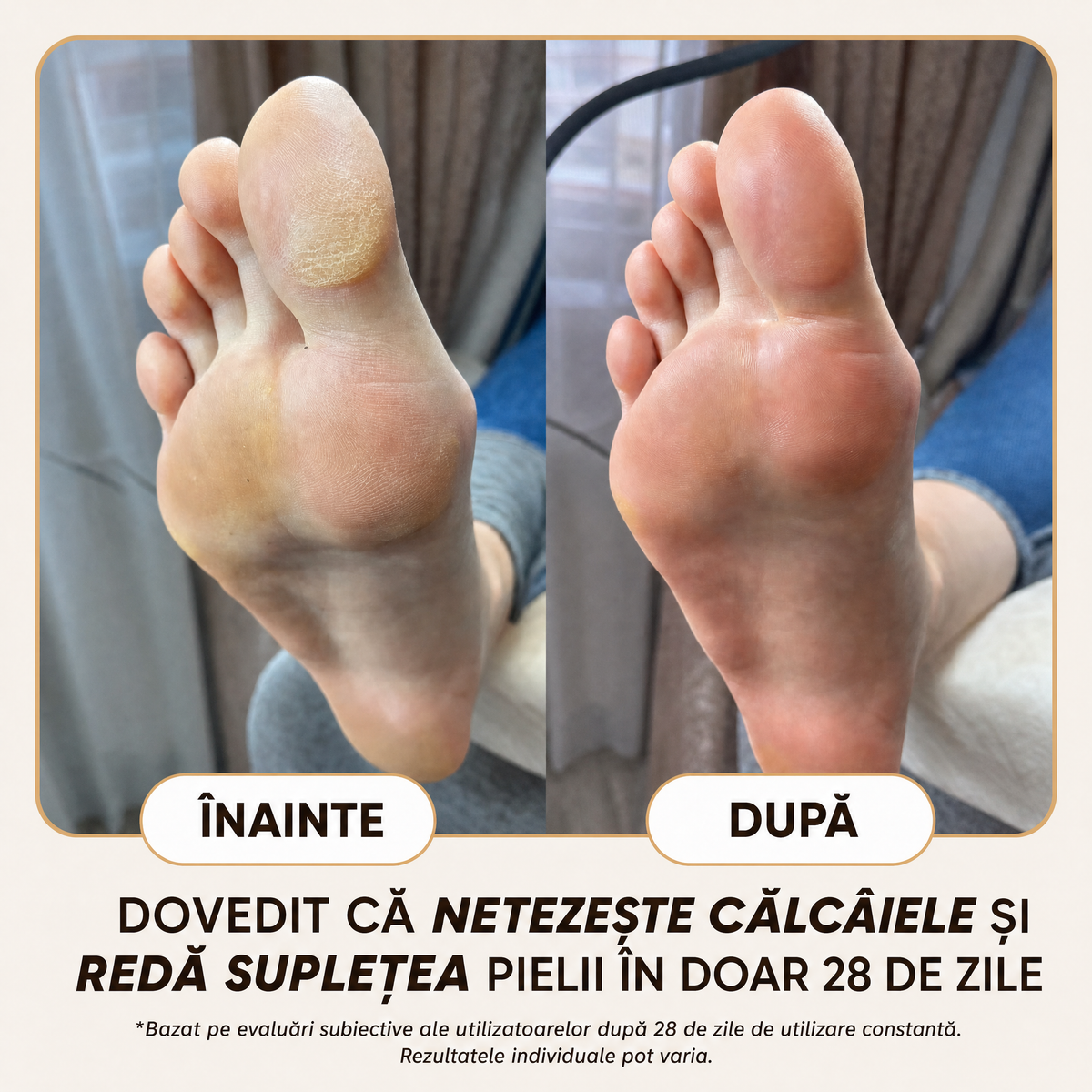 Cremă Naturală Picioare & Călcâie