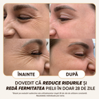 Cremă Naturală Antirid