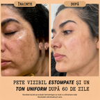 Crema Naturală Antipete