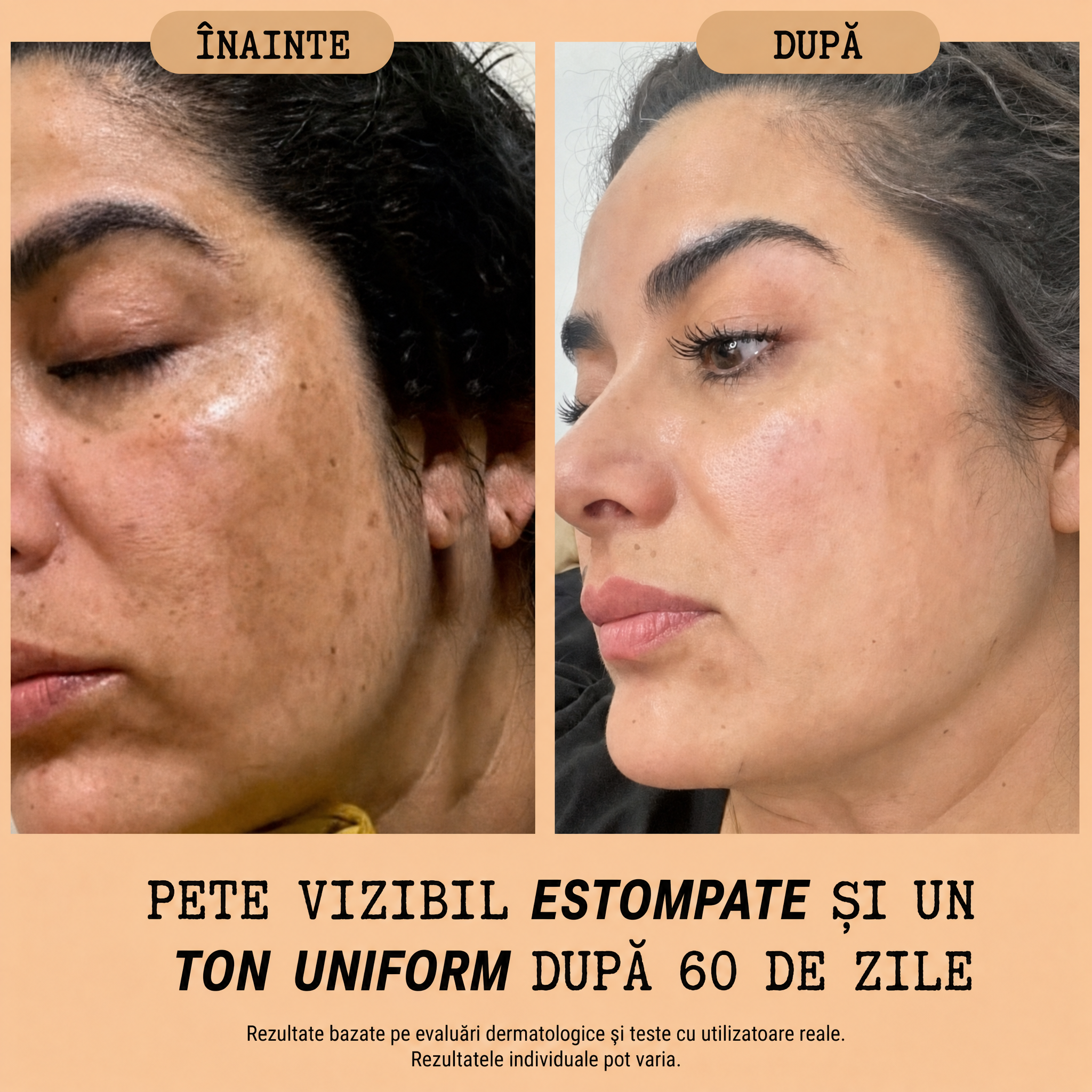Crema Naturală Antipete