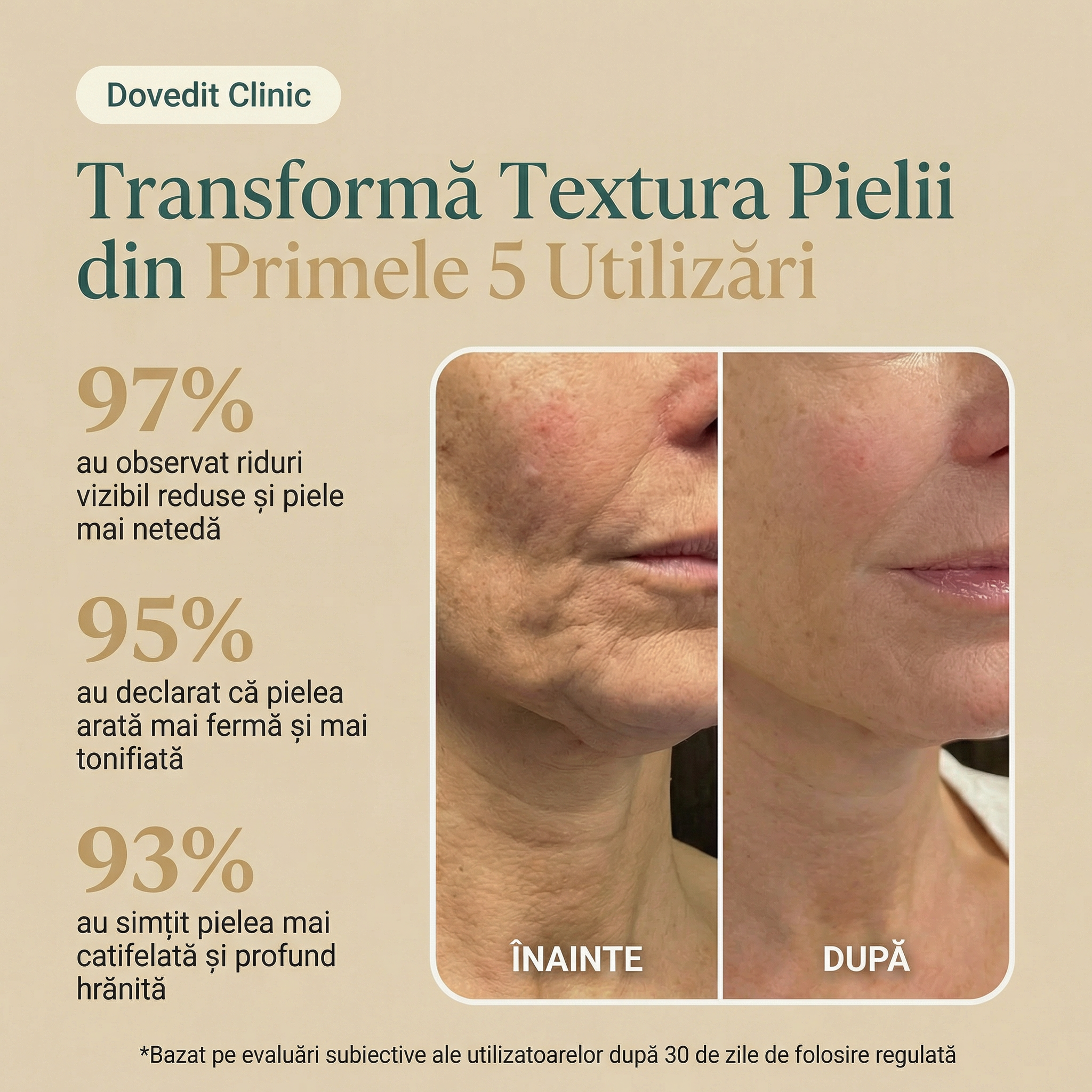 Cremă Naturală Antirid