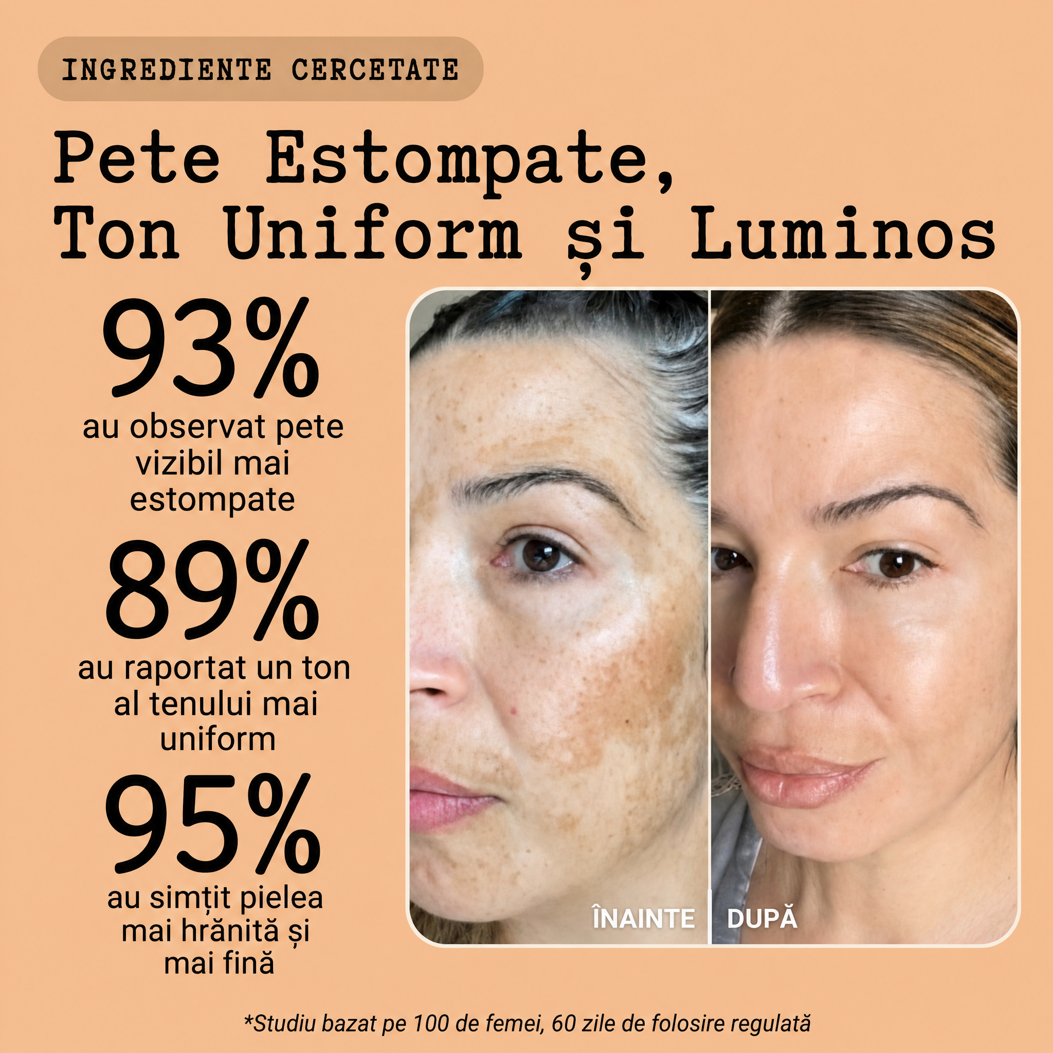 Crema Naturală Antipete
