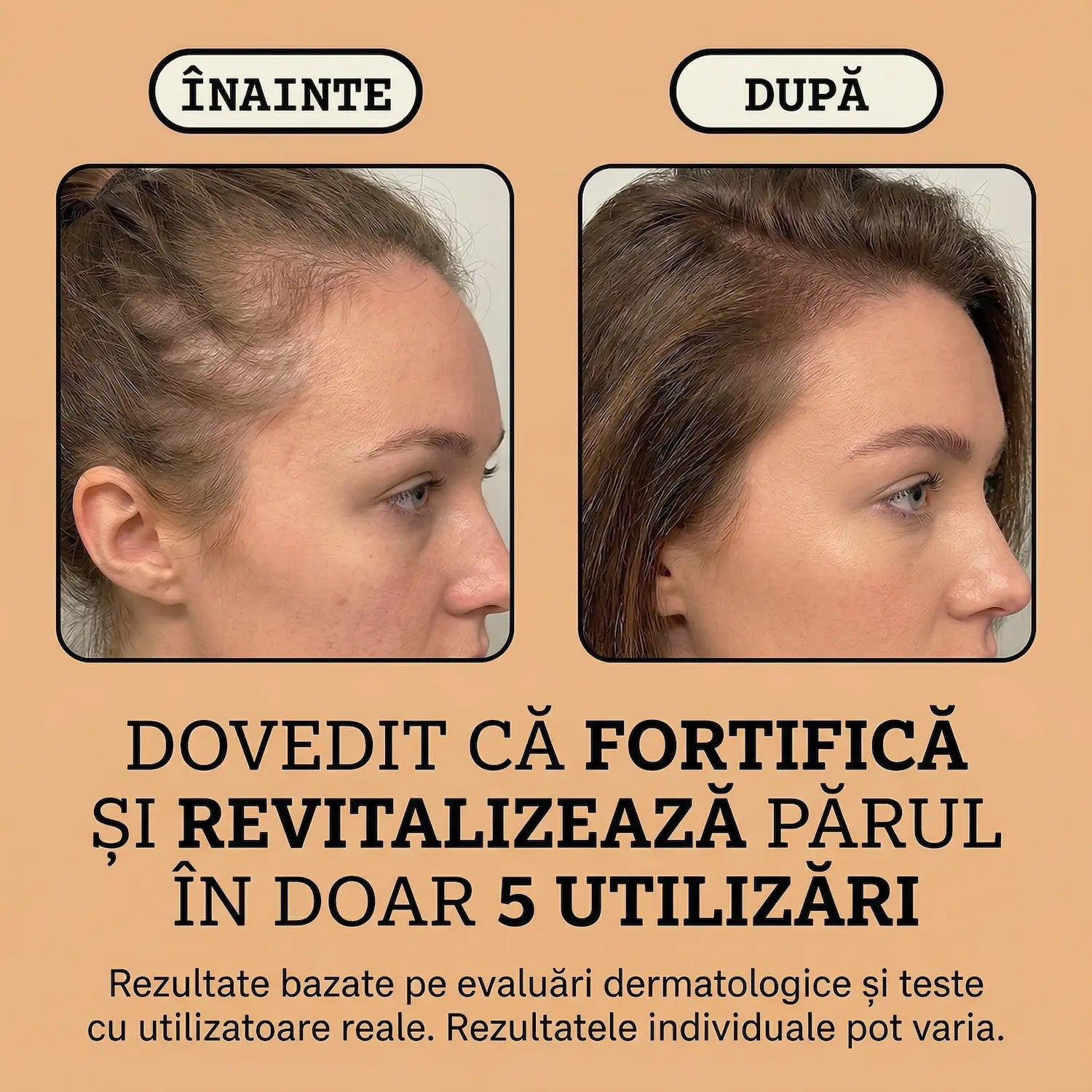 Balsam Natural Anticăderea Părului